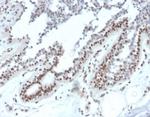 Nucleoside Diphosphate Kinase A/nm23-H1 Antibody in Immunohistochemistry (Paraffin) (IHC (P))