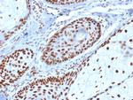 Nucleophosmin Antibody in Immunohistochemistry (Paraffin) (IHC (P))