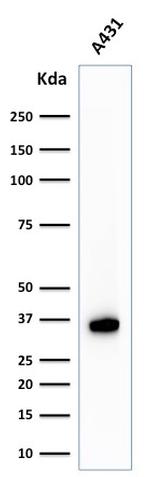 Nucleophosmin Antibody in Western Blot (WB)