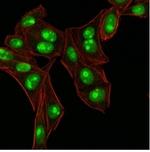 Nucleophosmin (Acute Myeloid Leukemia Marker) Antibody in Immunocytochemistry (ICC/IF)