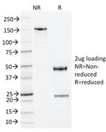 Nucleophosmin (Acute Myeloid Leukemia Marker) Antibody in SDS-PAGE (SDS-PAGE)