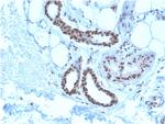 Nucleophosmin (Acute Myeloid Leukemia Marker) Antibody in Immunohistochemistry (Paraffin) (IHC (P))