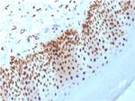 Nucleophosmin (Acute Myeloid Leukemia Marker) Antibody in Immunohistochemistry (Paraffin) (IHC (P))