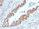 Nucleophosmin (Acute Myeloid Leukemia Marker) Antibody in Immunohistochemistry (Paraffin) (IHC (P))