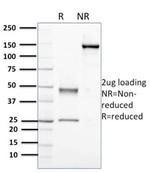 Nucleophosmin (Acute Myeloid Leukemia Marker) Antibody