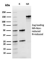 Nucleophosmin Antibody in SDS-PAGE (SDS-PAGE)