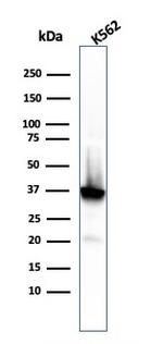 Nucleophosmin Antibody in Western Blot (WB)