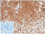 Nucleophosmin (Acute Myeloid Leukemia Marker) Antibody in Immunohistochemistry (Paraffin) (IHC (P))