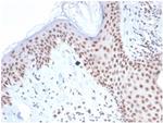 Nucleophosmin (Acute Myeloid Leukemia Marker) Antibody in Immunohistochemistry (Paraffin) (IHC (P))