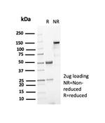 Nucleophosmin (Acute Myeloid Leukemia Marker) Antibody in SDS-PAGE (SDS-PAGE)