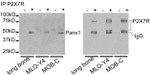 Pannexin 1 Antibody in Western Blot (WB)