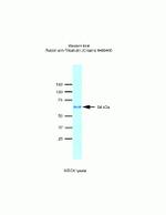 MARVELD2 Antibody in Western Blot (WB)