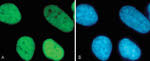 H3K9acK14ac Antibody in Immunocytochemistry (ICC/IF)