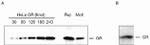 Glucocorticoid Receptor Antibody in Western Blot (WB)