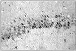 Glucocorticoid Receptor Antibody in Immunohistochemistry (IHC)