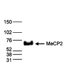 MECP2 Antibody in Western Blot (WB)