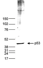 p53 Antibody in Western Blot (WB)