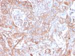 CD73 (Immuno-Oncology Target) Antibody in Immunohistochemistry (Paraffin) (IHC (P))