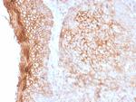 CD73 (Immuno-Oncology Target) Antibody in Immunohistochemistry (Paraffin) (IHC (P))