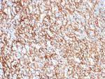 CD73 (Immuno-Oncology Target) Antibody in Immunohistochemistry (Paraffin) (IHC (P))