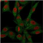 CD73 (Immuno-Oncology Target) Antibody in Immunocytochemistry (ICC/IF)