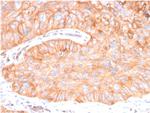 CD73 (Immuno-Oncology Target) Antibody in Immunohistochemistry (Paraffin) (IHC (P))