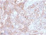 CD73 (Immuno-Oncology Target) Antibody in Immunohistochemistry (Paraffin) (IHC (P))