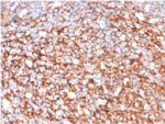 CD73 (Immuno-Oncology Target) Antibody in Immunohistochemistry (Paraffin) (IHC (P))