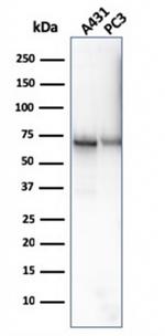 CD73 (Immuno-Oncology Target) Antibody in Western Blot (WB)