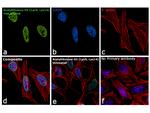 H3K9acK14ac Antibody