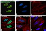 H3K9acK14ac Antibody in Immunocytochemistry (ICC/IF)