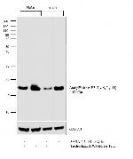 H3K9acK14ac Antibody in Western Blot (WB)