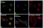 Glucocorticoid Receptor Antibody