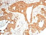 NTRK2 (Neurotrophic Receptor Tyrosine Kinase 2) Antibody in Immunohistochemistry (Paraffin) (IHC (P))