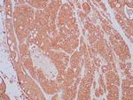 NTRK2 (Neurotrophic Receptor Tyrosine Kinase 2) Antibody in Immunohistochemistry (Paraffin) (IHC (P))