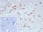 NTRK2 (Neurotrophic Receptor Tyrosine Kinase 2) Antibody in Immunohistochemistry (Paraffin) (IHC (P))