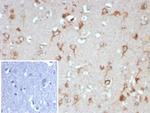 NTRK2 (Neurotrophic Receptor Tyrosine Kinase 2) Antibody in Immunohistochemistry (Paraffin) (IHC (P))