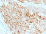 ROR2 Antibody in Immunohistochemistry (Paraffin) (IHC (P))