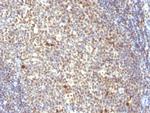 Nuclear Mitotic Apparatus Protein (NuMA) Antibody in Immunohistochemistry (Paraffin) (IHC (P))