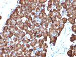 Ornithine Decarboxylase-1 (ODC-1) Antibody in Immunohistochemistry (Paraffin) (IHC (P))