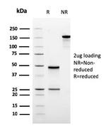 Ornithine Decarboxylase-1 (ODC-1) Antibody in SDS-PAGE (SDS-PAGE)