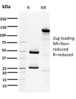 ORC1 Antibody in SDS-PAGE (SDS-PAGE)