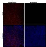 CD8a Antibody in Immunohistochemistry (Paraffin) (IHC (P))