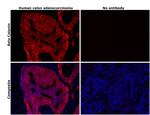 beta Catenin Antibody in Immunohistochemistry (Paraffin) (IHC (P))