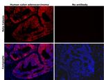 beta Catenin Antibody in Immunohistochemistry (Paraffin) (IHC (P))