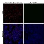 Ki-67 Antibody in Immunohistochemistry (Paraffin) (IHC (P))