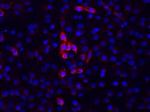 IgM Antibody in Immunocytochemistry (ICC/IF)