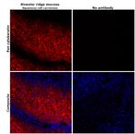 Pan Cytokeratin Antibody in Immunohistochemistry (Paraffin) (IHC (P))