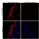 Pan Cytokeratin Antibody in Immunohistochemistry (Paraffin) (IHC (P))