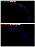 Pan Cytokeratin Antibody in Immunohistochemistry (Paraffin) (IHC (P))